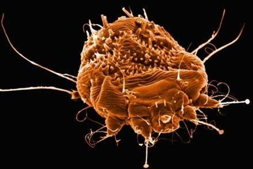 Scabbia a scuola ma niente allarmismo