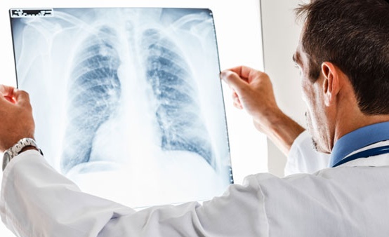 Coronavirus, sospese in Lombardia tutte le attività ambulatoriali non urgenti