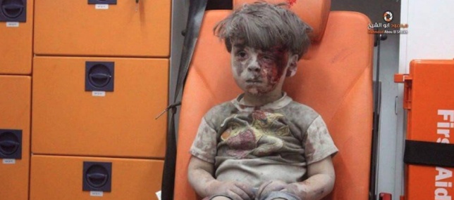 Come sta ora il bimbo di Aleppo