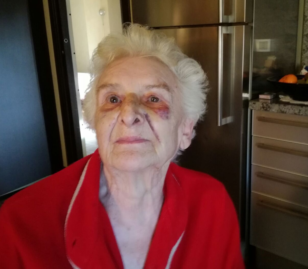 Picchiata e rapinata in casa, anziana terrorizzata