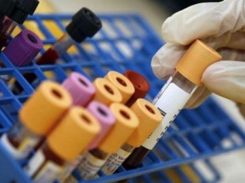 Epidemia polmonite: negato l’accesso agli atti al Comitato di Salute