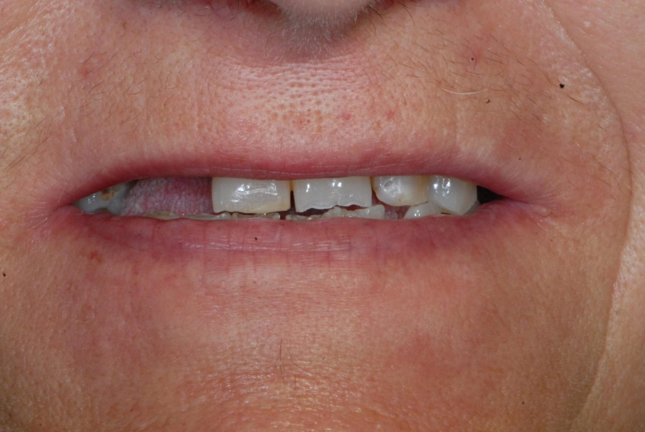 Riabilitazioni dento facciali