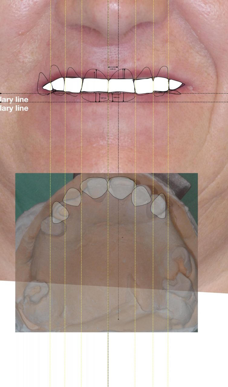 Riabilitazioni dento facciali