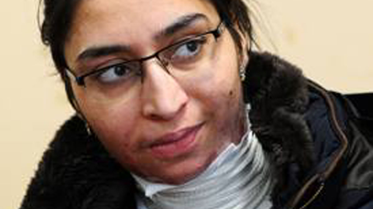 Bruciò Pinky, confermata la condanna a 14 anni per l’ex marito