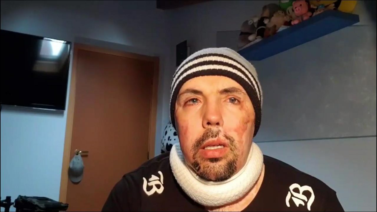 Sfigurato dall’acido lanciato dall’ex: ora il Tribunale gli chiede pure 50mila euro