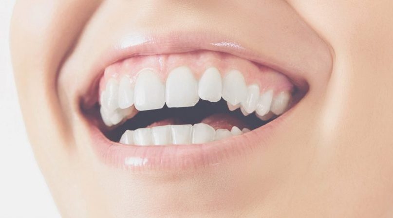 La zirconia in implantologia: un’importante rivoluzione