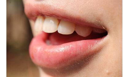 Igiene orale e donne: i periodi più rischiosi e il fattore ormoni
