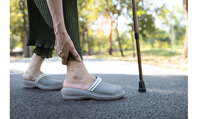 Protesi di caviglia a Brescia: a chi rivolgersi e quando farla