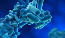 Legionella nei bagni della palestra dei Novagli e all'asilo delle Marcolini