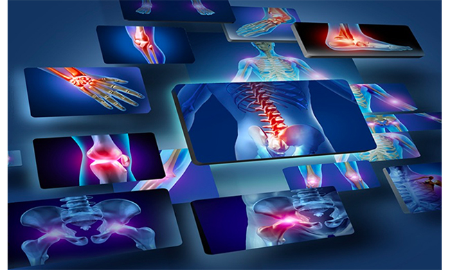 Ortopedia personalizzata a Capriolo, grazie all’approccio del dottor Alberto Caramagno