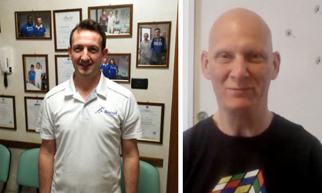 Il trattamento Bonori per la sclerosi multipla: la testimonianza di Andy
