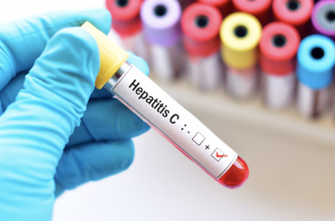 Asst Garda: domani lo screening per l’Epatite C (HCV), ecco dove e in quali orari