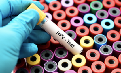 Test HPV per la prevenzione del tumore del collo dell'utero, cosa c'è da sapere