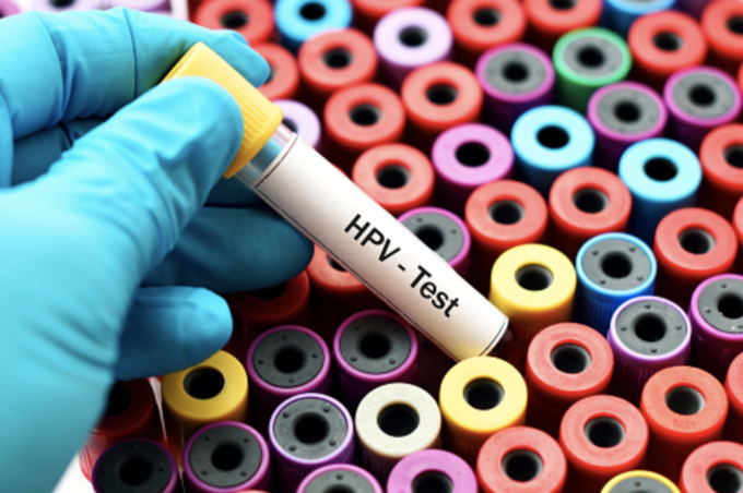 Test HPV per la prevenzione del tumore del collo dell’utero, cosa c’è da sapere