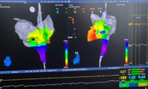 ASST Garda: da tutta Italia in cardiologia a Desenzano per il Training formativo sull’ablazione cardiaca