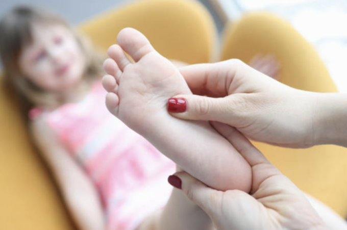 Piedi piatti nei bambini: cosa fare? La parola all’ortopedico Guido Carbone