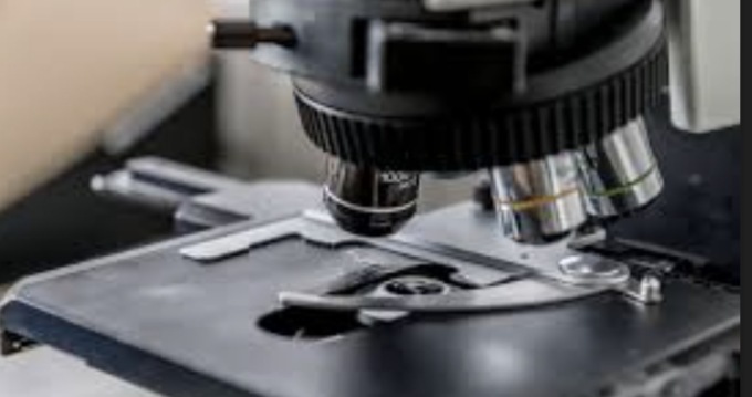 Tossinfezione alimentare a Erbusco, interviene Ats Brescia: 3 positivi alla salmonella