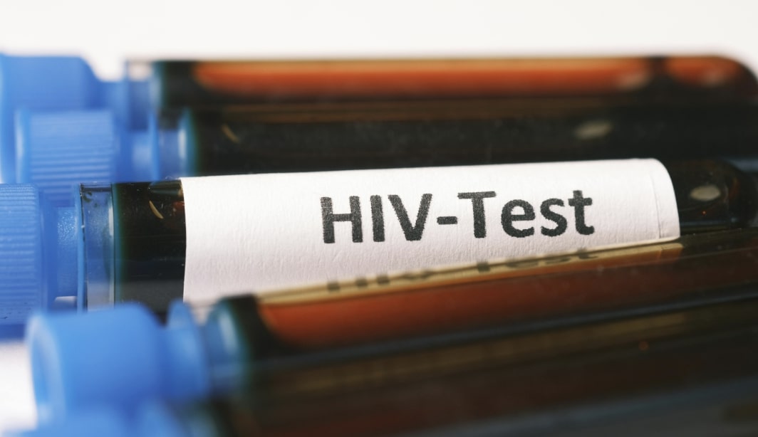 Infezioni sessualmente trasmesse: quattro giornate di sensibilizzazione a Desenzano e Salò