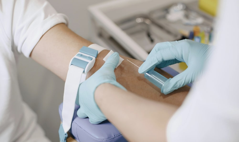 Attività di Prelievo a Castelcovati: non è più necessaria la prenotazione