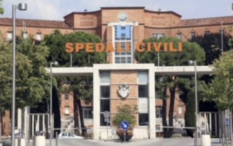 Patologie dell’aorta: Spedali Civili primo centro in Lombardia nel trattamento